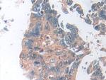 SOD2 Antibody in Immunohistochemistry (Paraffin) (IHC (P))