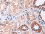 SOD2 Antibody in Immunohistochemistry (Paraffin) (IHC (P))