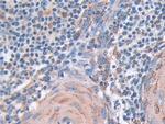 SOD2 Antibody in Immunohistochemistry (Paraffin) (IHC (P))