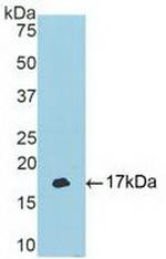 TBX3 Antibody in Western Blot (WB)