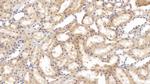 Tenascin C Antibody in Immunohistochemistry (Paraffin) (IHC (P))