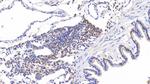 Tenascin C Antibody in Immunohistochemistry (Paraffin) (IHC (P))