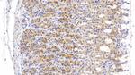 Tenascin C Antibody in Immunohistochemistry (Paraffin) (IHC (P))