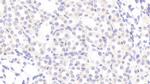 Tenascin C Antibody in Immunohistochemistry (Paraffin) (IHC (P))