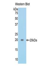 Tenascin C Antibody in Western Blot (WB)