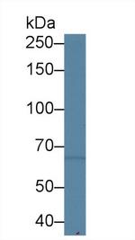 SLC26A8 Antibody in Western Blot (WB)