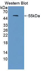 TK1 Antibody in Western Blot (WB)