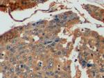 Thymidylate Synthase Antibody in Immunohistochemistry (Paraffin) (IHC (P))