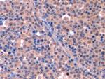 Thymidylate Synthase Antibody in Immunohistochemistry (Paraffin) (IHC (P))