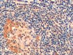 Thymidylate Synthase Antibody in Immunohistochemistry (Paraffin) (IHC (P))