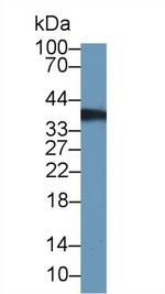 Thymidylate Synthase Antibody in Western Blot (WB)