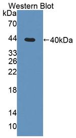 TSTA3 Antibody in Western Blot (WB)