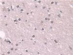 Transketolase Antibody in Immunohistochemistry (Paraffin) (IHC (P))