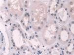 Transketolase Antibody in Immunohistochemistry (Paraffin) (IHC (P))