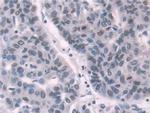 Transketolase Antibody in Immunohistochemistry (Paraffin) (IHC (P))