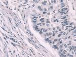 Transketolase Antibody in Immunohistochemistry (Paraffin) (IHC (P))