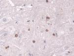 Transketolase Antibody in Immunohistochemistry (Paraffin) (IHC (P))