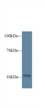 Triadin Antibody in Western Blot (WB)