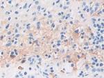 TPPP Antibody in Immunohistochemistry (Paraffin) (IHC (P))