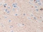 TPPP Antibody in Immunohistochemistry (Paraffin) (IHC (P))