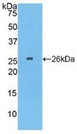 TPPP Antibody in Western Blot (WB)