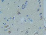 TNFR1 Antibody in Immunohistochemistry (Paraffin) (IHC (P))