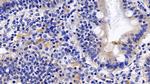 TNFR1 Antibody in Immunohistochemistry (Paraffin) (IHC (P))