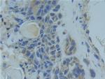 TNFR1 Antibody in Immunohistochemistry (Paraffin) (IHC (P))