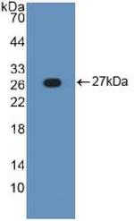 TNFR1 Antibody in Western Blot (WB)