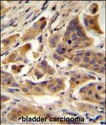 RBCK1 Antibody in Immunohistochemistry (Paraffin) (IHC (P))