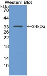 p53 Antibody in Western Blot (WB)