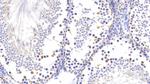 PGP9.5 Antibody in Immunohistochemistry (Paraffin) (IHC (P))