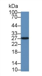 PGP9.5 Antibody in Western Blot (WB)