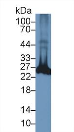 PGP9.5 Antibody in Western Blot (WB)