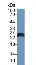 PGP9.5 Antibody in Western Blot (WB)