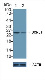 PGP9.5 Antibody in Western Blot (WB)