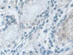 VCP Antibody in Immunohistochemistry (Paraffin) (IHC (P))