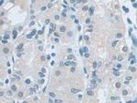 VCP Antibody in Immunohistochemistry (Paraffin) (IHC (P))