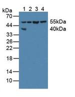 XIAP Antibody in Western Blot (WB)