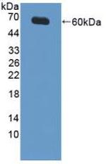 XIAP Antibody in Western Blot (WB)