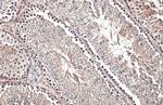 Androgen Receptor (ARv7 Splice Variant) Antibody in Immunohistochemistry (Paraffin) (IHC (P))