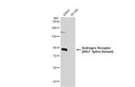 Androgen Receptor (ARv7 Splice Variant) Antibody in Western Blot (WB)