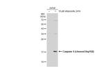 Caspase 6 (Cleaved Asp162) Antibody in Western Blot (WB)