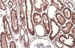 Cathepsin B Antibody in Immunohistochemistry (Paraffin) (IHC (P))