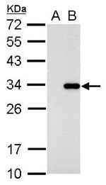 CDK2 Antibody in Western Blot (WB)