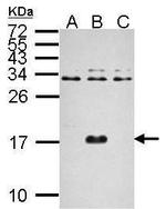 Dengue Virus Type 2 Capsid Antibody in Western Blot (WB)