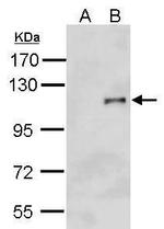 HA Tag Antibody in Western Blot (WB)