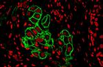 ErbB2 (HER-2) Antibody in Immunohistochemistry (Paraffin) (IHC (P))