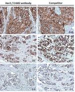 ErbB2 (HER-2) Antibody in Immunohistochemistry (Paraffin) (IHC (P))