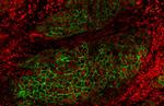 ErbB2 (HER-2) Antibody in Immunohistochemistry (Paraffin) (IHC (P))